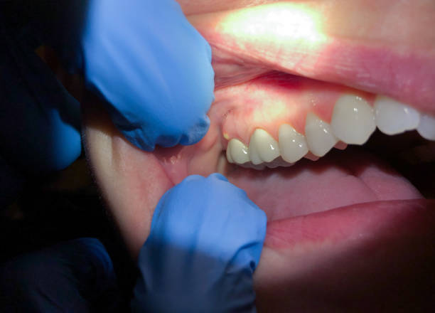 Best Urgent Dental Care for Toothaches in Vineyard Haven, MA